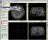 ITK-SNAP - From ITK-SNAP's main window you will be able to load, preview and analyze 3D medical images.