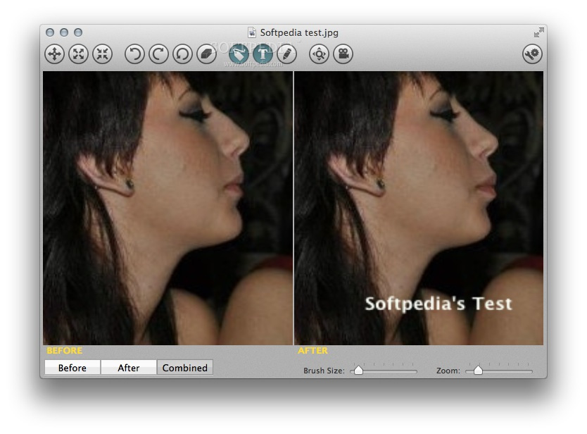 plastic surgery software download