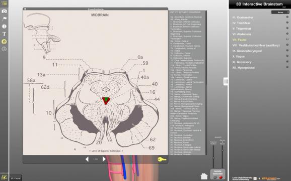 Interactive 3D Brainstem screenshot